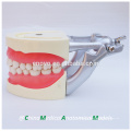 Soft Gum Dental Teaching Model for Teeth Preparing Training 13010